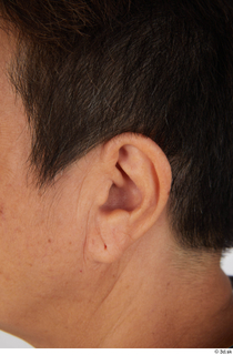 Photos Tan Jiahao ear 0001.jpg